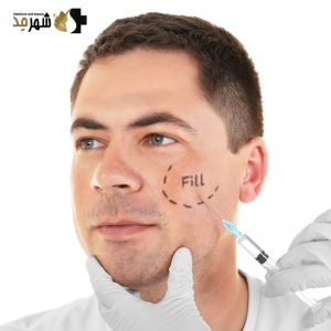 فیلر (ژل) رووفیل مدل اولترا