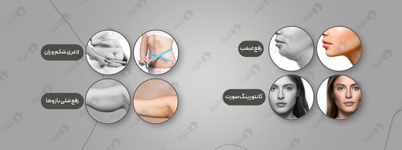 کوکتل مزوتراپی لاغری و رفع سلولیت رویتاکر مدل سلوکر