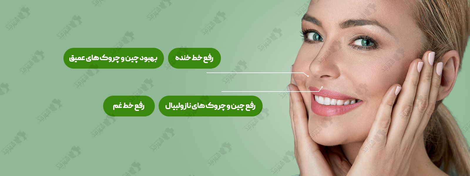 فیلر (ژل) 2 سی سی سوئیسی آلیاکسین مدل جی پی