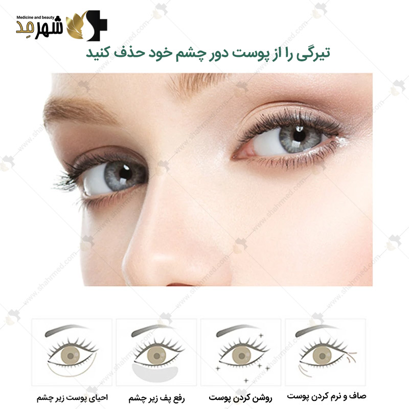 ماسک دور چشم 60 عددی ابیوگ مدل کریستال یخی Ice Crystal Eye Mask EBUG