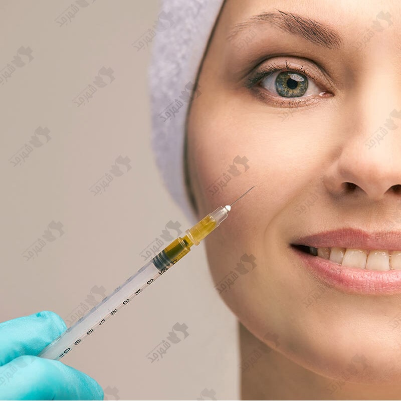 کیت پی آر پی کرهای مای سل PRP Kit MyCells