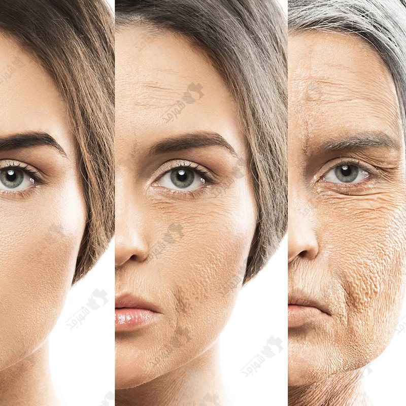 کیت پی آر پی کرهای مای سل PRP Kit MyCells