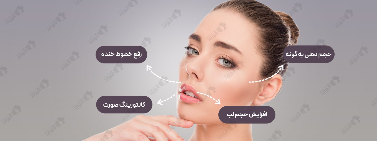 فیلر (ژل) 10 سی سی کره‌ای ریمدیوم مدل اچ
