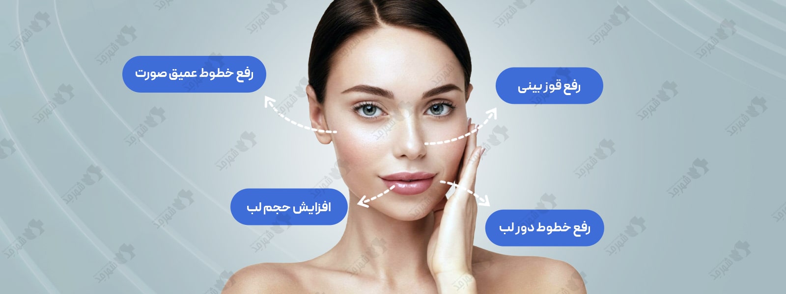 فیلر (ژل) 1 سی سی آلمانی درمال استایل مدل اسمایل به همراه لیدوکائین