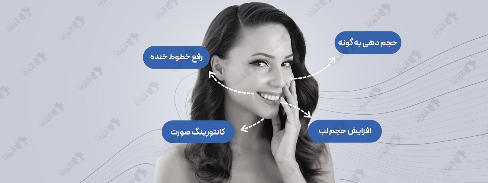 فیلر (ژل) 10 سی سی کره‌ای ولوس