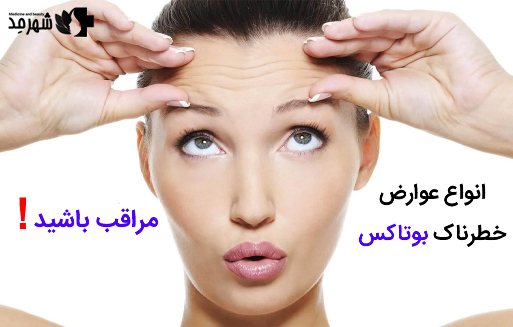 مراقب عوارض خطرناک بوتاکس باشید!